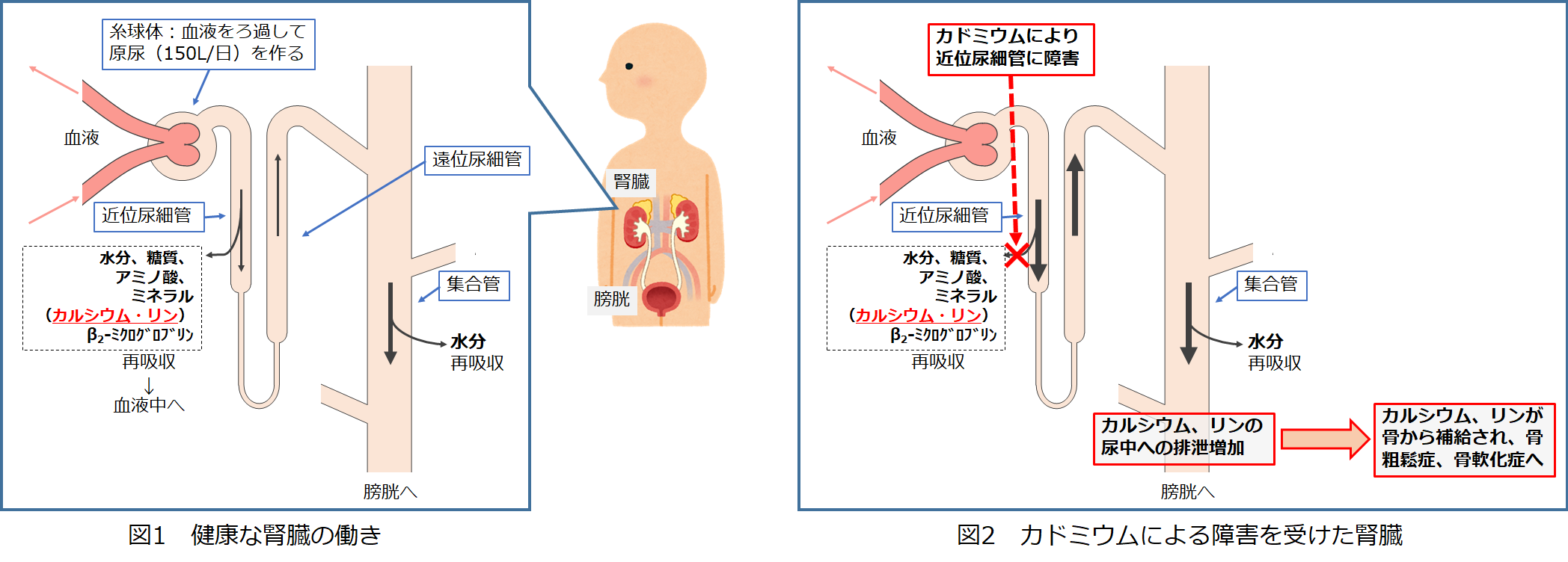 図1.健康な腎臓の働き、図2.カドミウムによる障害を受けた腎臓