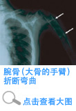 Agricultural and fishery damage and Itai-Itai Disease