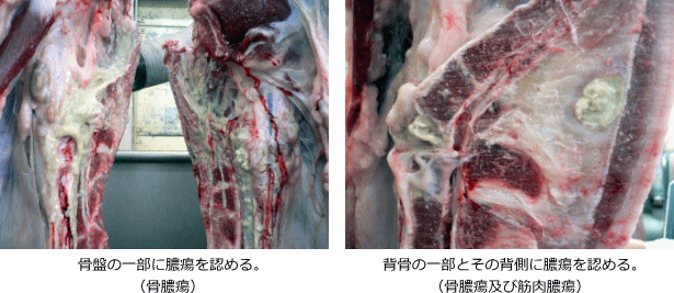 膿毒症の写真